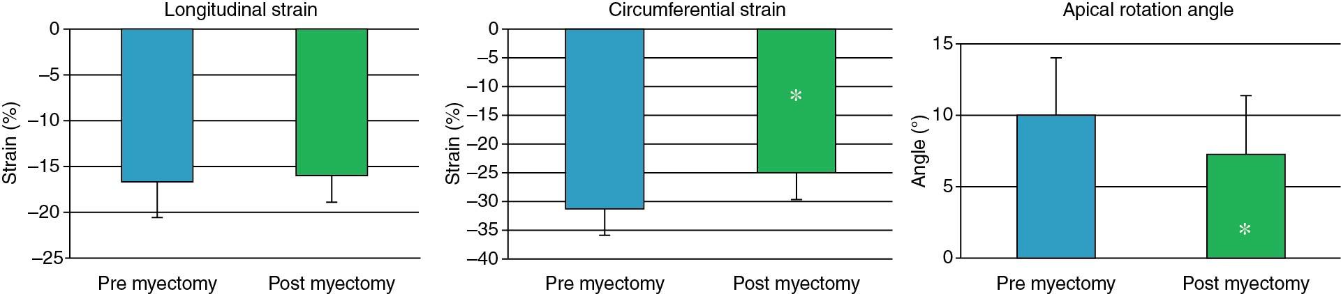 Fig. 4.3, Left ventricular (LV) deformation responses to myomectomy. Longitudinal strain is impaired and does not increase after myectomy. Circumferential deformation and apical counterclockwise rotation are greater than normal before intervention and decrease after myectomy.
