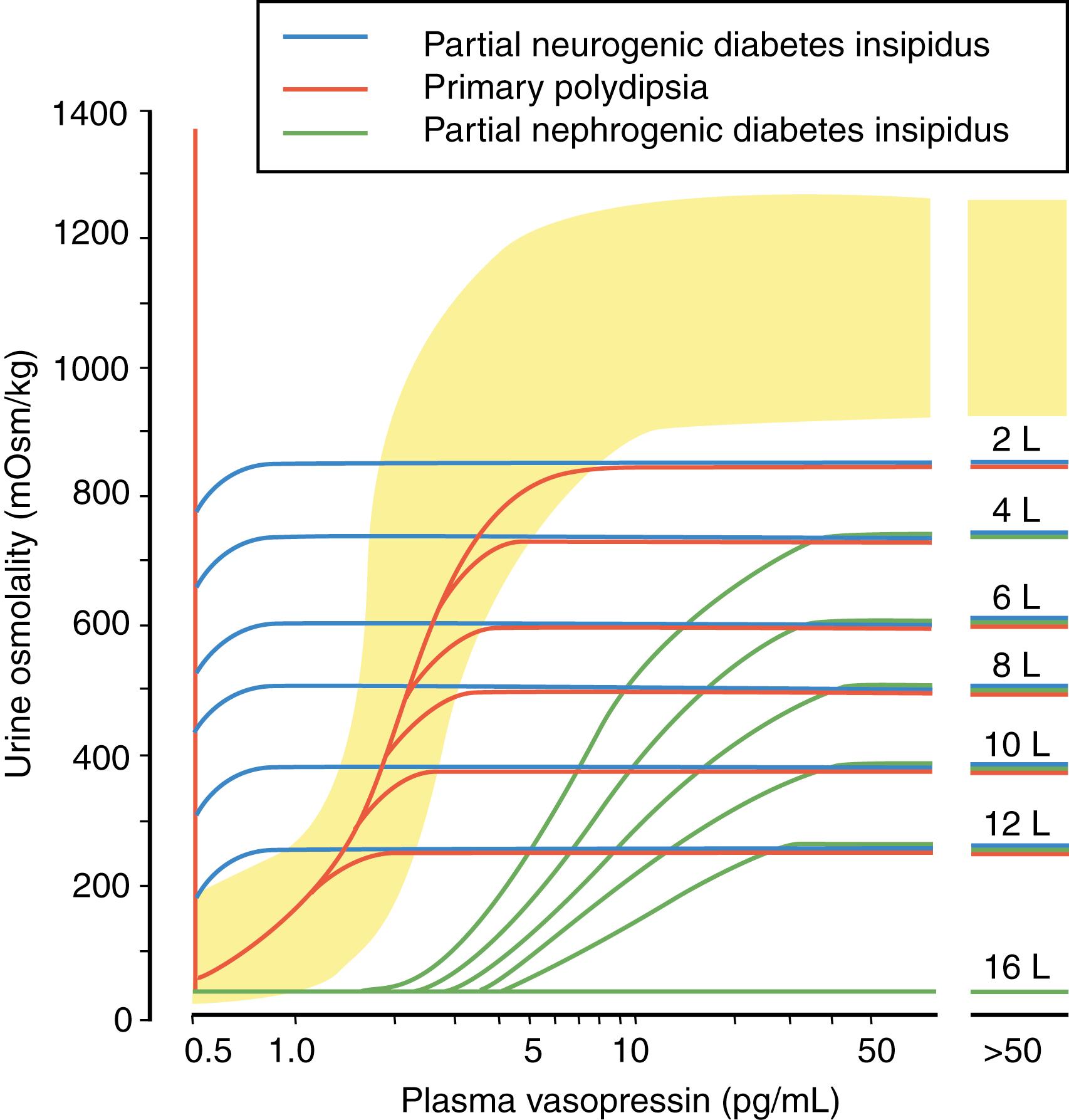 Figure 25.3, The relationship between urine osmolality (Uosm) and plasma arginine vasopressin (AVP/ADH) in patients with polyuria of diverse causes and severity. Each of the three categories of polyuria is described by its own family of sigmoid curves of differing heights. Differences in height within a family reflect differences in maximum concentrating capacity caused by “washout” of the medullary concentration gradient. They are proportional to the severity of the polyuria (indicated in liters per day at the right end of each plateau). The normal response is depicted in yellow. The three categories of polyuria differ principally in the ascending portion of the dose-response curve. In patients with partial neurogenic diabetes insipidus (DI), the curve lies to the left of normal, reflecting increased sensitivity to the antidiuretic effects of very low concentrations of plasma ADH. In contrast, in patients with partial nephrogenic DI, the curve lies to the right of normal, reflecting decreased sensitivity to ADH. In primary polydipsia, the relationship of Uosm to ADH remains relatively normal.