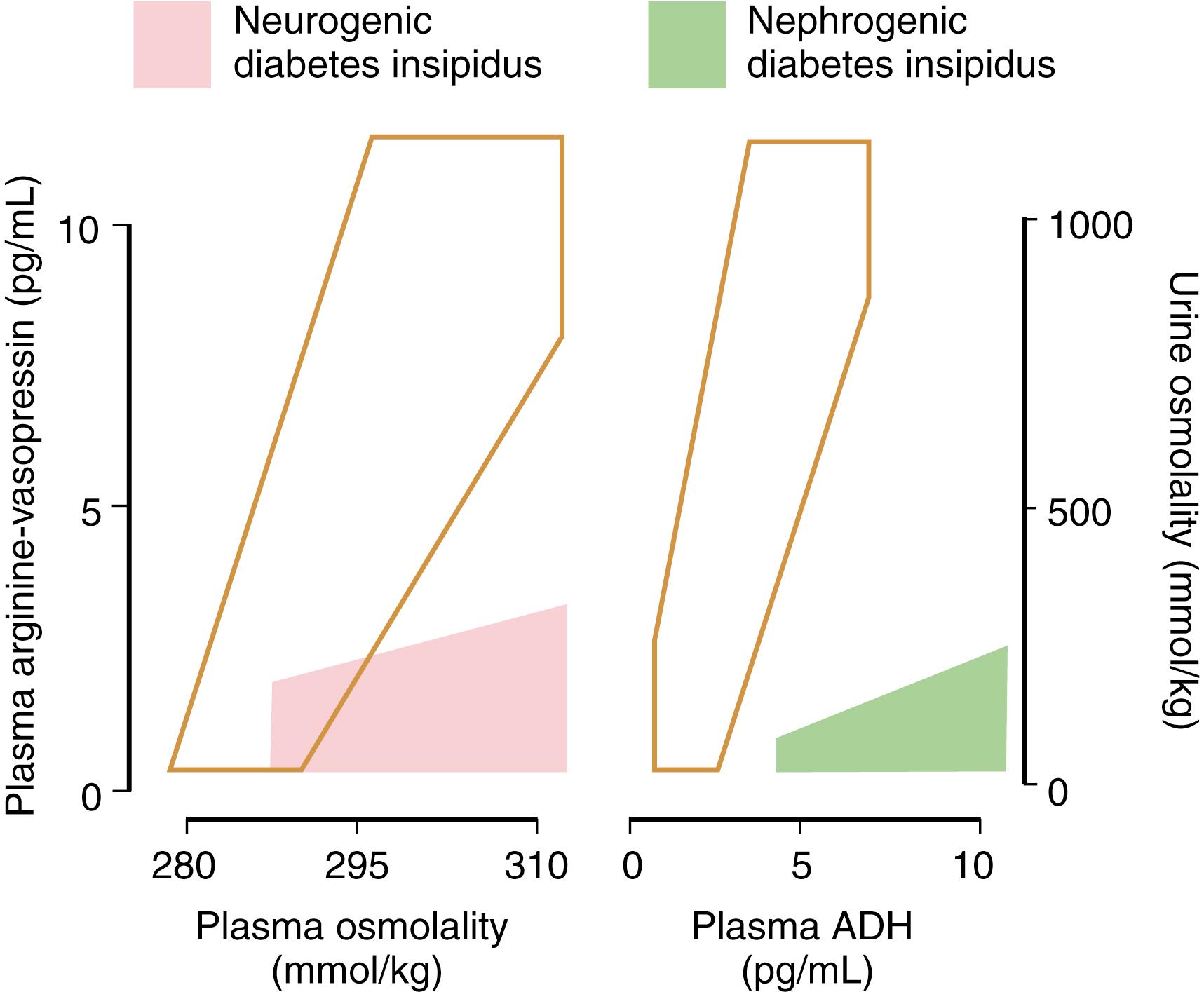 Figure 25.4, Left, Relationship between plasma arginine vasopressin (AVP/ADH) and plasma osmolality during the infusion of hypertonic saline. Patients with primary polydipsia and nephrogenic diabetes insipidus (DI) have values within the normal range (open area) in contrast to patients with neurogenic DI, who show a subnormal plasma ADH response to a rise in osmolality (pink). Right, Relationship between urine osmolality and plasma ADH during dehydration and water loading. Patients with primary polydipsia and neurogenic DI have values within the normal range (open area) in contrast to patients with nephrogenic DI, who have hypotonic urine despite high plasma ADH (green).