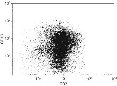 Figure 57-6, Flow-cytometric scatter plot of the CD45-weak blast cell area in a patient with residual acute myeloid leukemia.