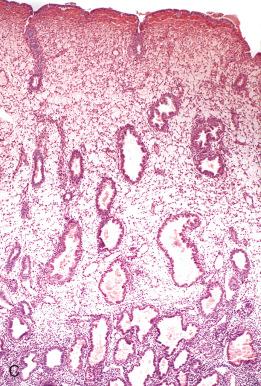 Fig. 16.10, Day 22, with prominent edema and secretory exhausted glands.