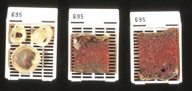 Fig. 31.2, Membrane roll, cord, and two full-thickness placenta sections are sent for processing.