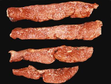 Fig. 31.21, Sectioned surface of a normal term placenta showing homogeneous consistency.