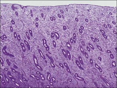 Figure 15.1, Normal proliferative endometrium (normal estrogen effect).