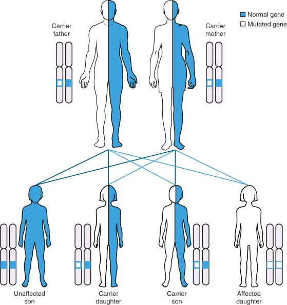 • Fig. 26.1, Autosomal recessive (AR) inheritance pattern. In AR inheritance, each unaffected parent carries a mutation in one copy of the same gene. The risk for an affected offspring having inherited both mutations is 25%.