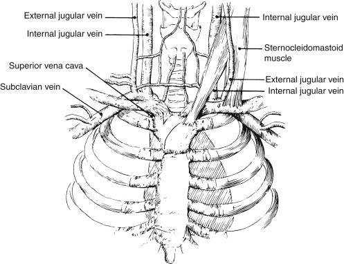 FIGURE 3, Central venous anatomy at the thoracic outlet.