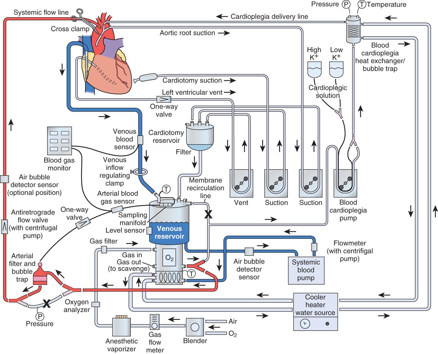 Fig. 26.2, Schematic diagram of cardiopulmonary bypass circuit, including four roller pumps (one vent pump, two suction pumps, and a cardioplegia deliver pump). A centrifugal blood pump for systemic blood propulsion is shown on the lower right.