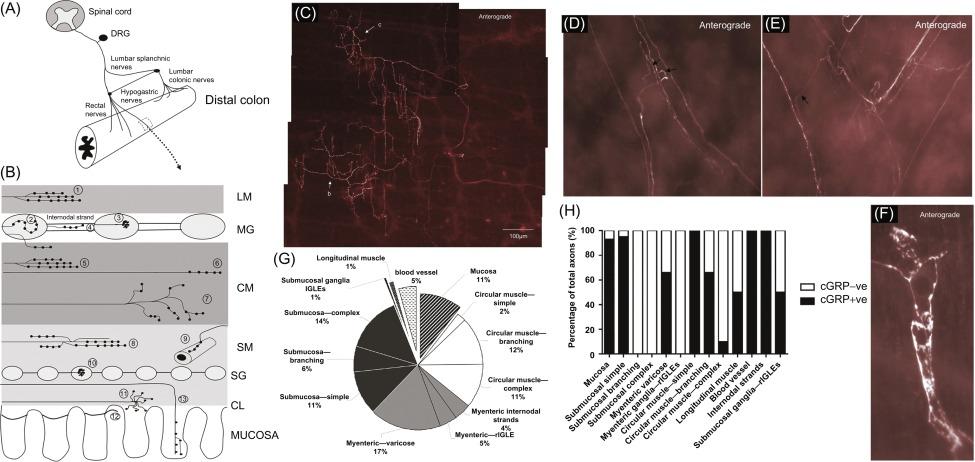 Fig. 17.4, Morphological classification of the spinal afferents innervating the colon via the pelvic innervation. (A,B) Diagrammatic representation of the different types of spinal afferent endings identified in the mouse large intestine, following in vivo injections of dextran biotin into lumbosacral DRG. Anterograde labeling from lumbosacral DRG in vivo revealing (C) a “complex-type” spinal afferent nerve ending in the circular muscle layer, (D,E) spinal afferent endings and axons surrounding blood vessels, and (F) rare rectal intraganglionic laminar endings (rIGLEs) in submucosal ganglia. (G) Graphical representation of the relative proportion of spinal afferent nerve endings that innervate distinct anatomical sites within the large intestine and (H) the percentage of labeled spinal afferent endings that were immunoreactive (positive and negative) for CGRP.