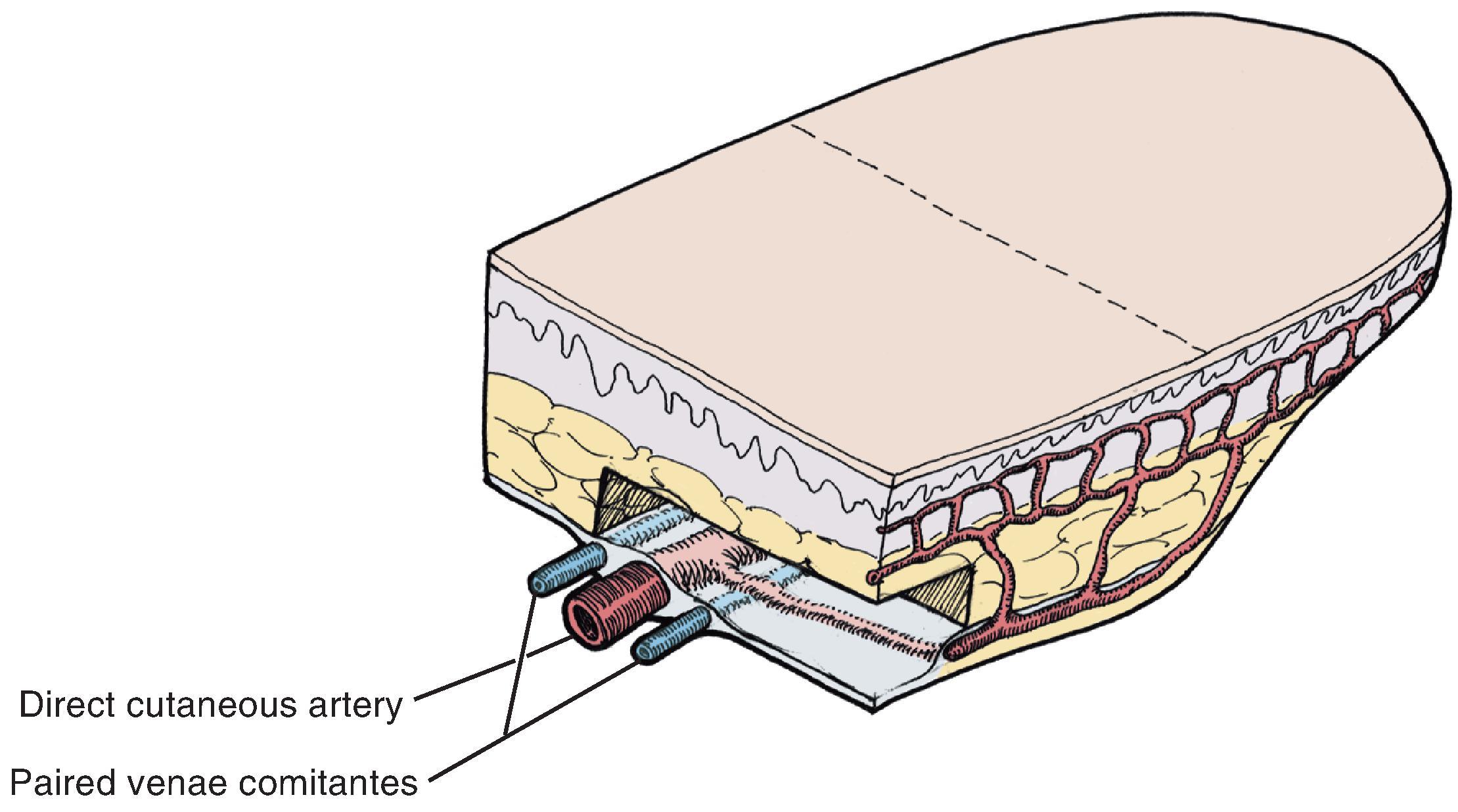 FIG. 6.7, Axial pattern flaps based on named artery for blood supply. Most axial pattern flaps have a degree of random pattern to distal portion. (From Swanson NA: Classification, definitions, and concepts in flap surgery. In Baker SR, Swanson NA [eds]: Local Flaps in Facial Reconstruction . Mosby, 1995, p 69, Fig. 9, with permission.)