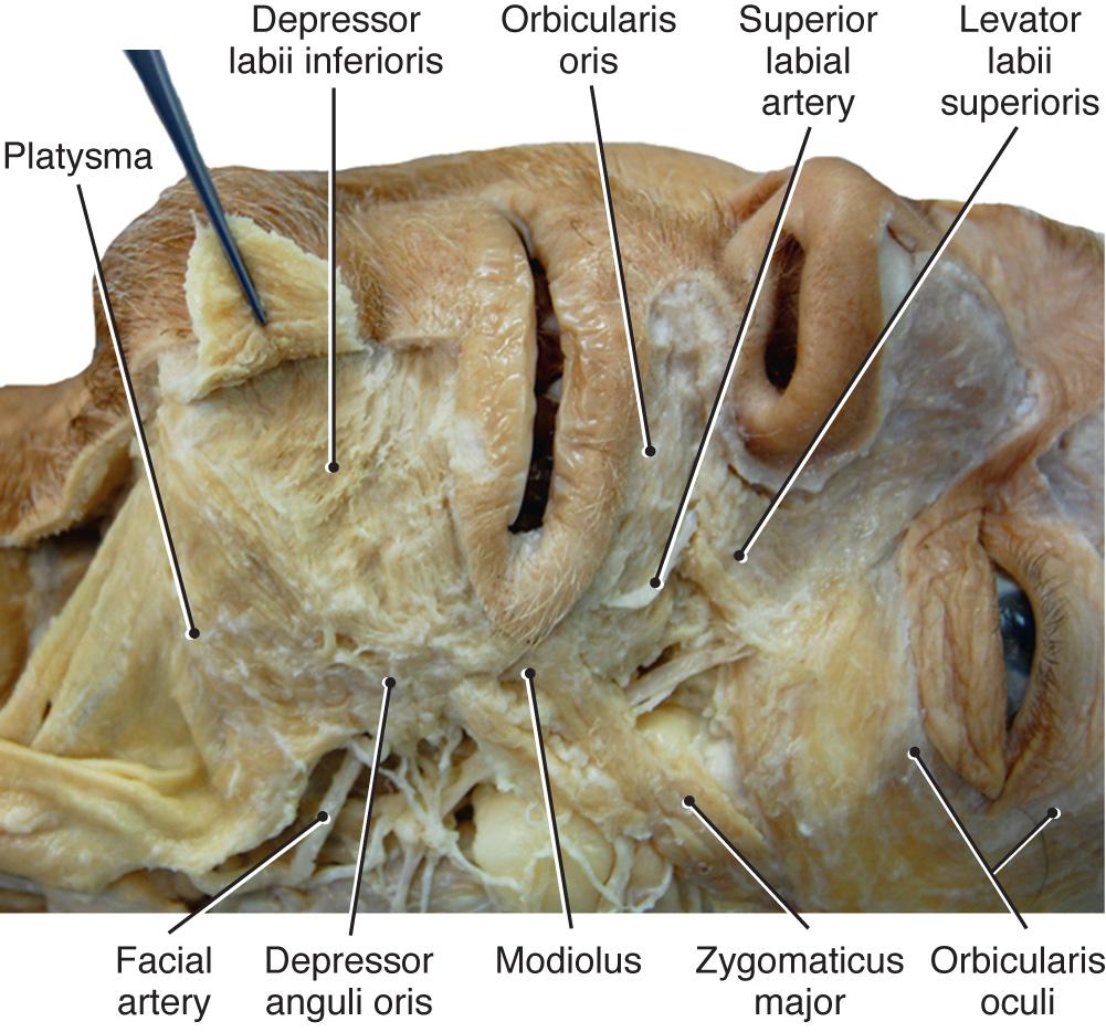 Fig. 21.10, Anterior view of mandible and neck with skin removed, revealing muscles.