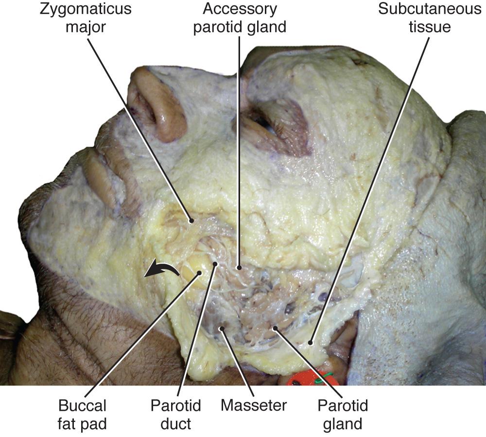 Fig. 21.7, Lateral facial view with skin reflected and SMAS removed from the mandibular region.