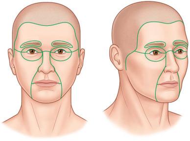 FIG. 4.4.1, Facial esthetic units.