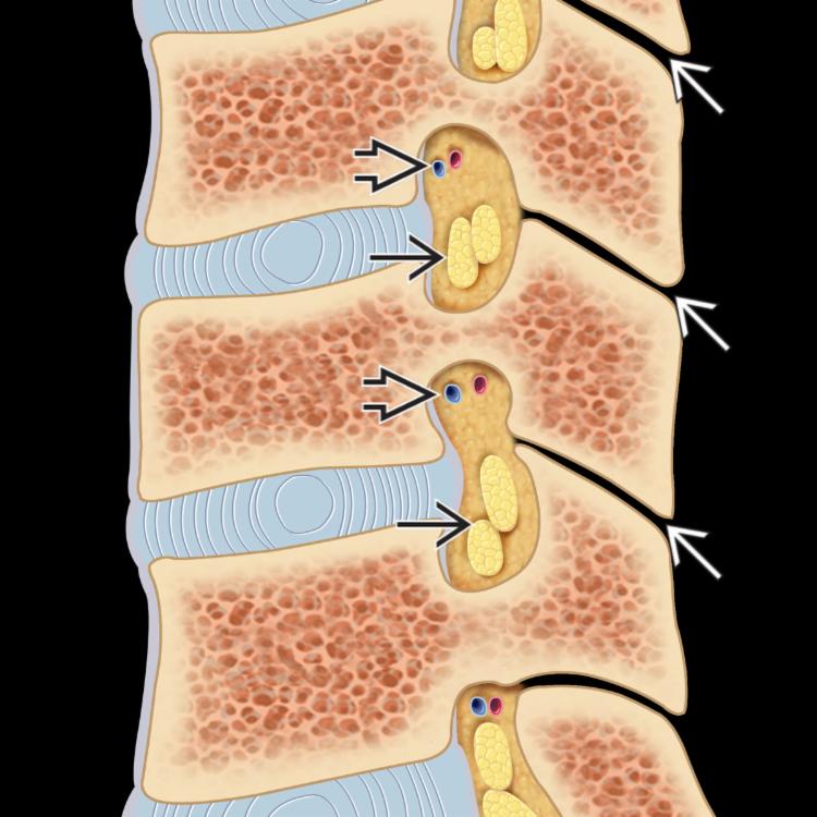 Normal Anatomy