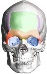 Fig. 8.2, Frontonasoorbital complex, color coded.