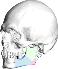 Fig. 8.3, Jaw and chin complex, color coded.