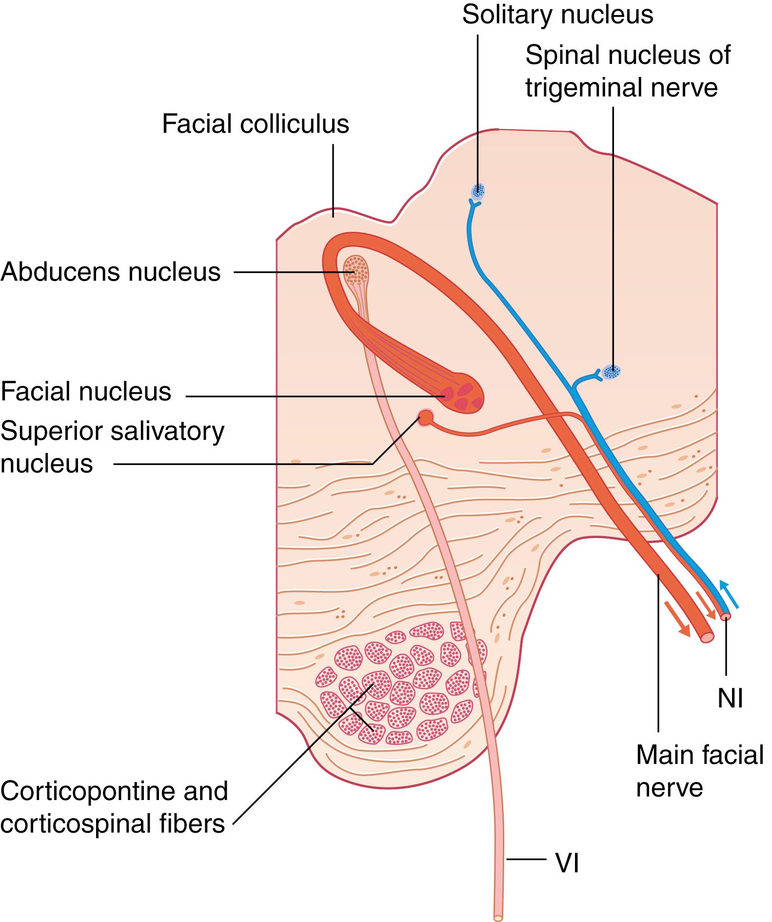Fig. 1.2, Transverse section of the brainstem showing the intrapontine course of the facial nerve from the facial motor nucleus, superior salivatory nucleus, and solitary nucleus. NI, Nervus intermedius.
