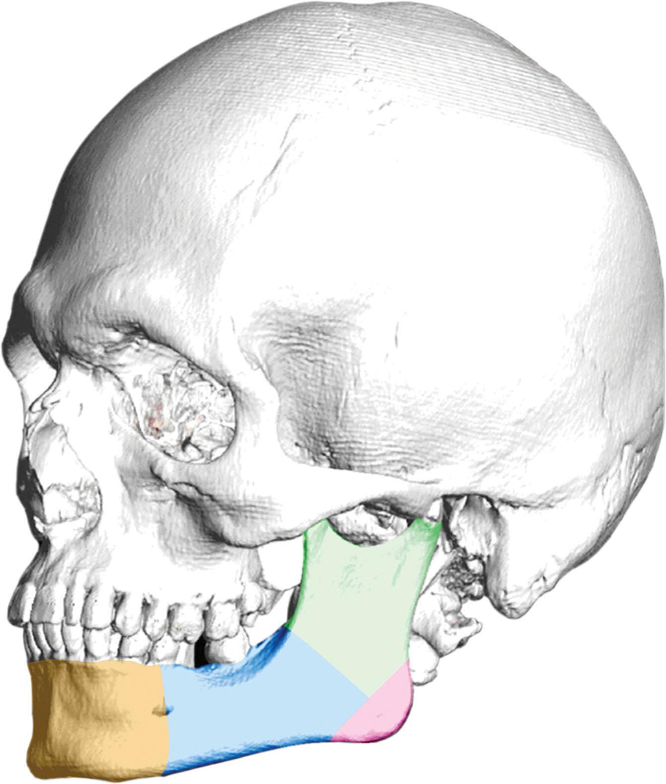 Figure 17.4, Lower jaw features, color coded. Light brown: chin; blue: mandibular body; pink: mandibular angle; green: ascending ramus.