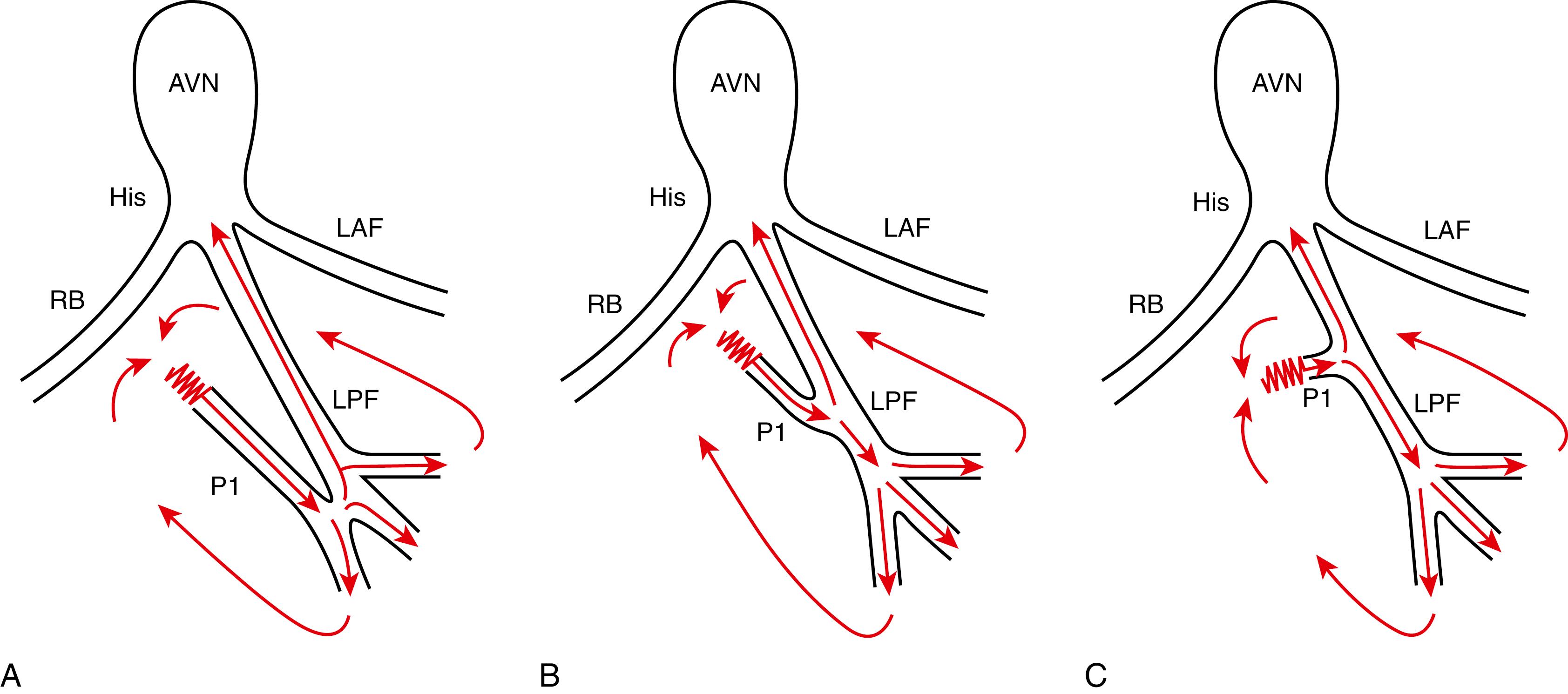 Fig. 83.3, Schematic diagram of the LPF-VT reentry circuit.