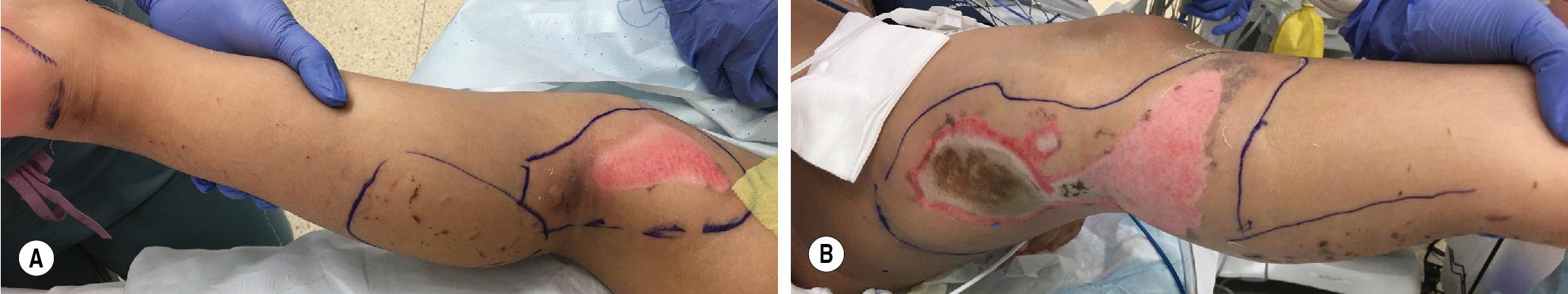 FIGURE 2.3, Skin lesions are light.