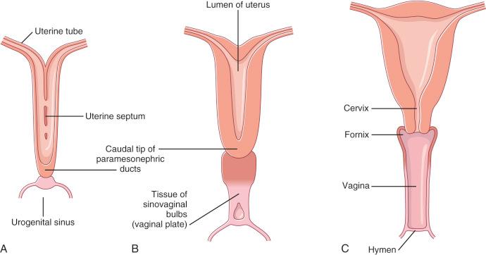 Fig. 1.7, Schematic of uterine and vaginal development.