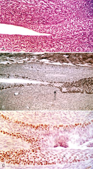 Fig. 1.8, A, Junction of müllerian (left) and vaginal squamous (right) epithelium in the mouse embryo. B, p63 expression highlights the induction of squamous differentiation in the latter (right). C, At high power, both the urethra (upper left) and vagina (lower left and right) in the fetal mouse express p63 during urothelial (u) and squamous (s) differentiation, respectively.