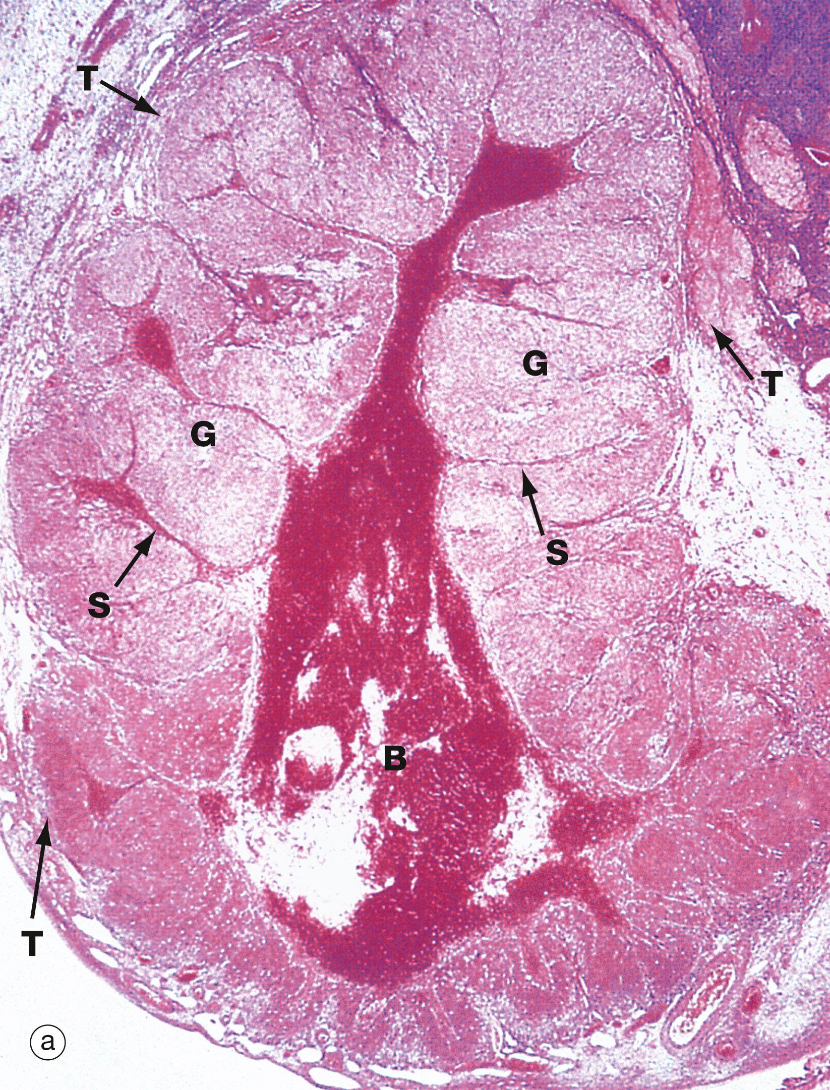 Fig. 19.8, Corpus luteum of menstruation