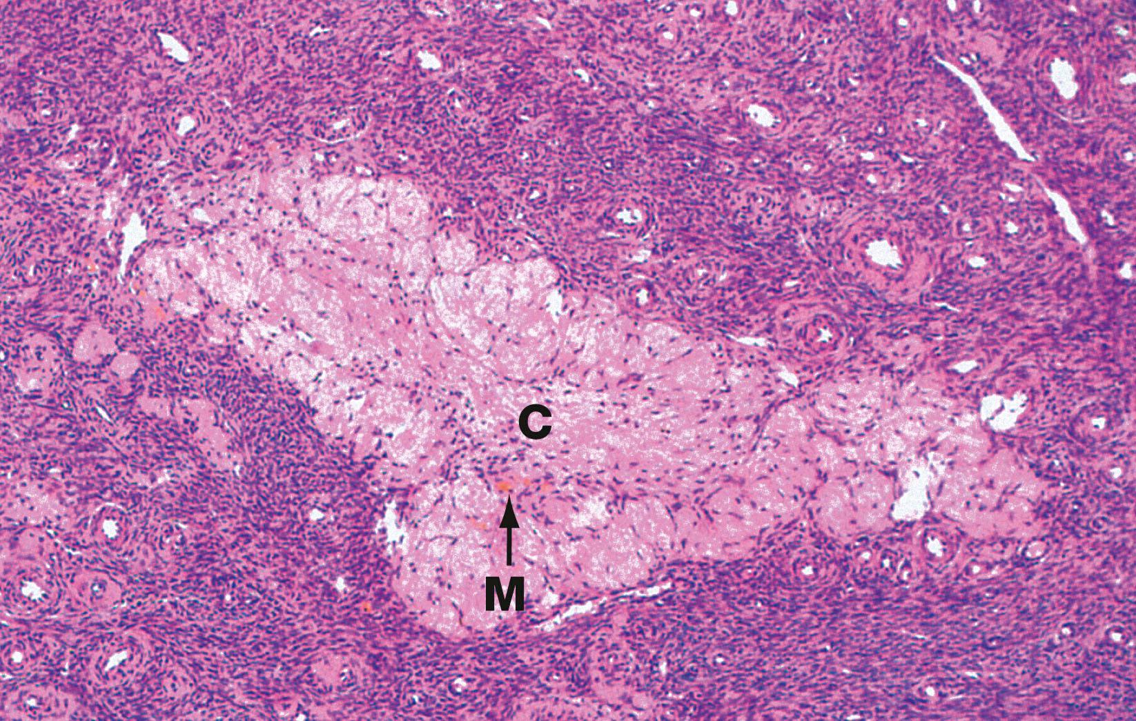 Fig. 19.11, Corpus albicans H&E (LP)