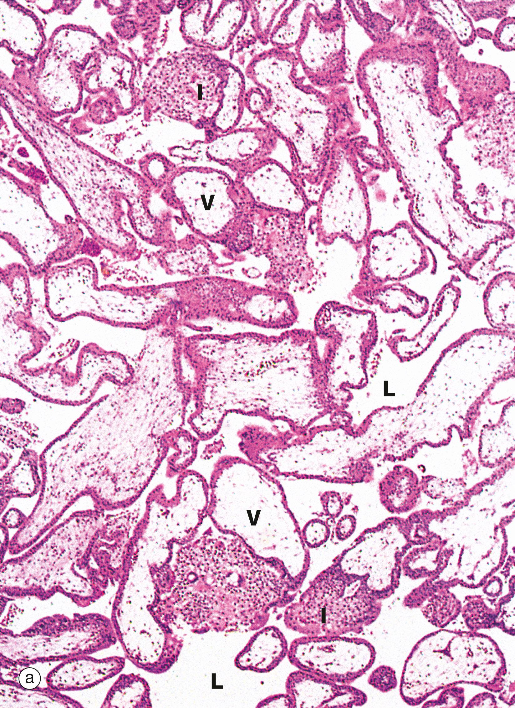 Fig. 19.31, Early placenta