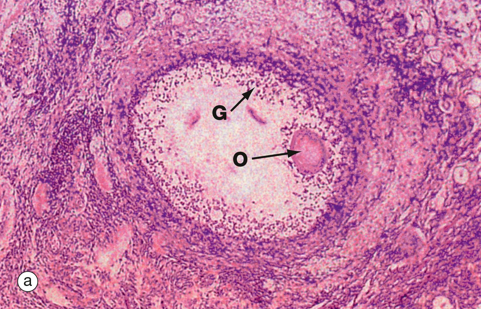 Fig. 19.10, Atretic follicles