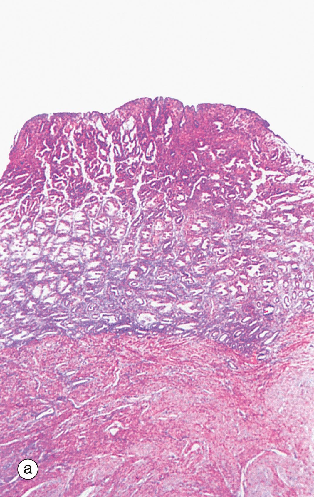 Fig. 19.16, Endometrium, the onset of menstruation