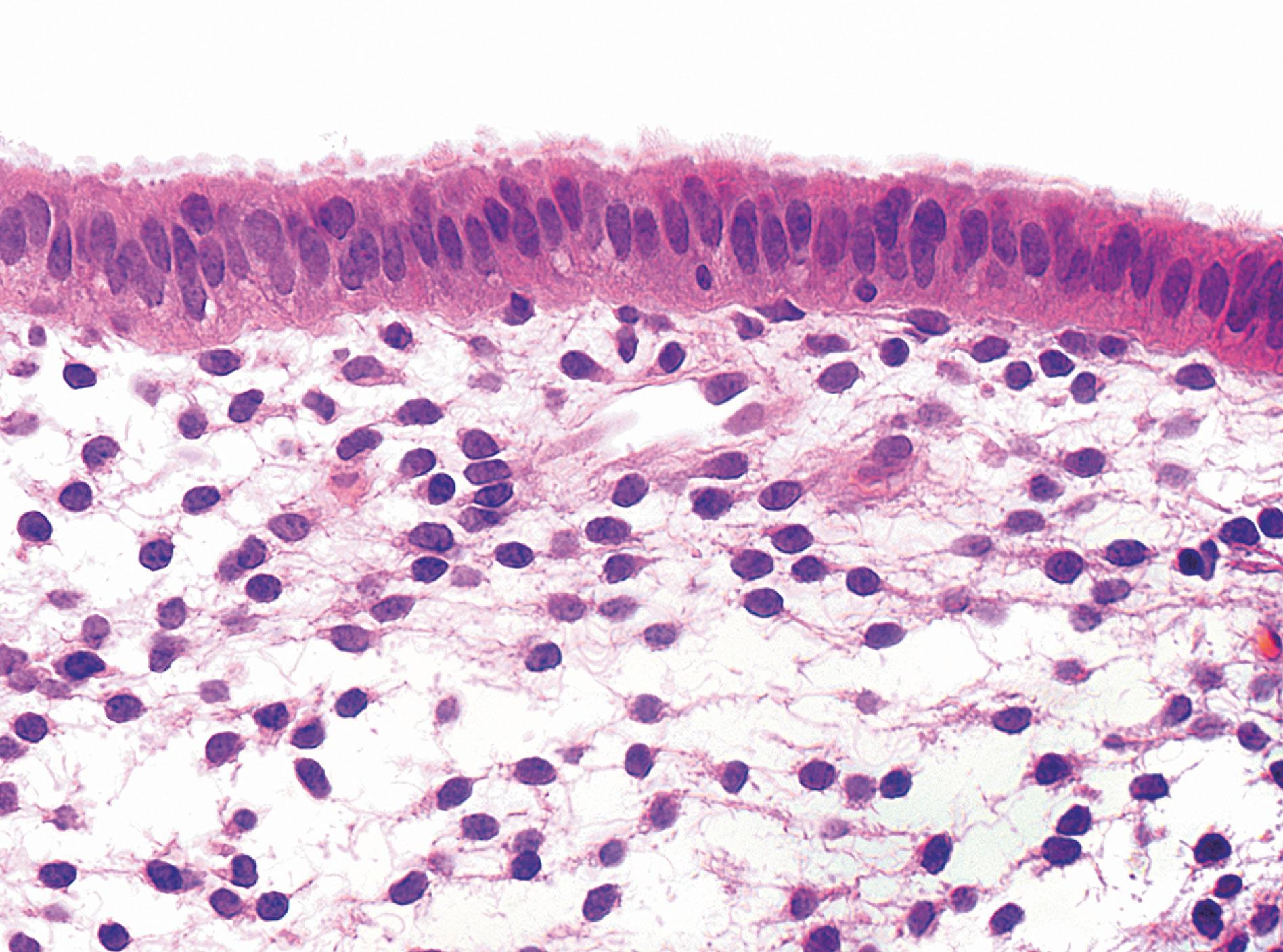 Fig. 19.17, Endometrial surface H&E (HP)