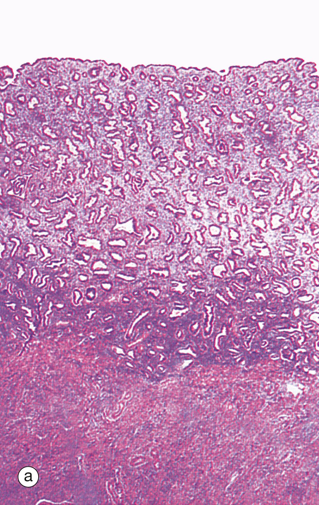 Fig. 19.19, Secretory endometrium