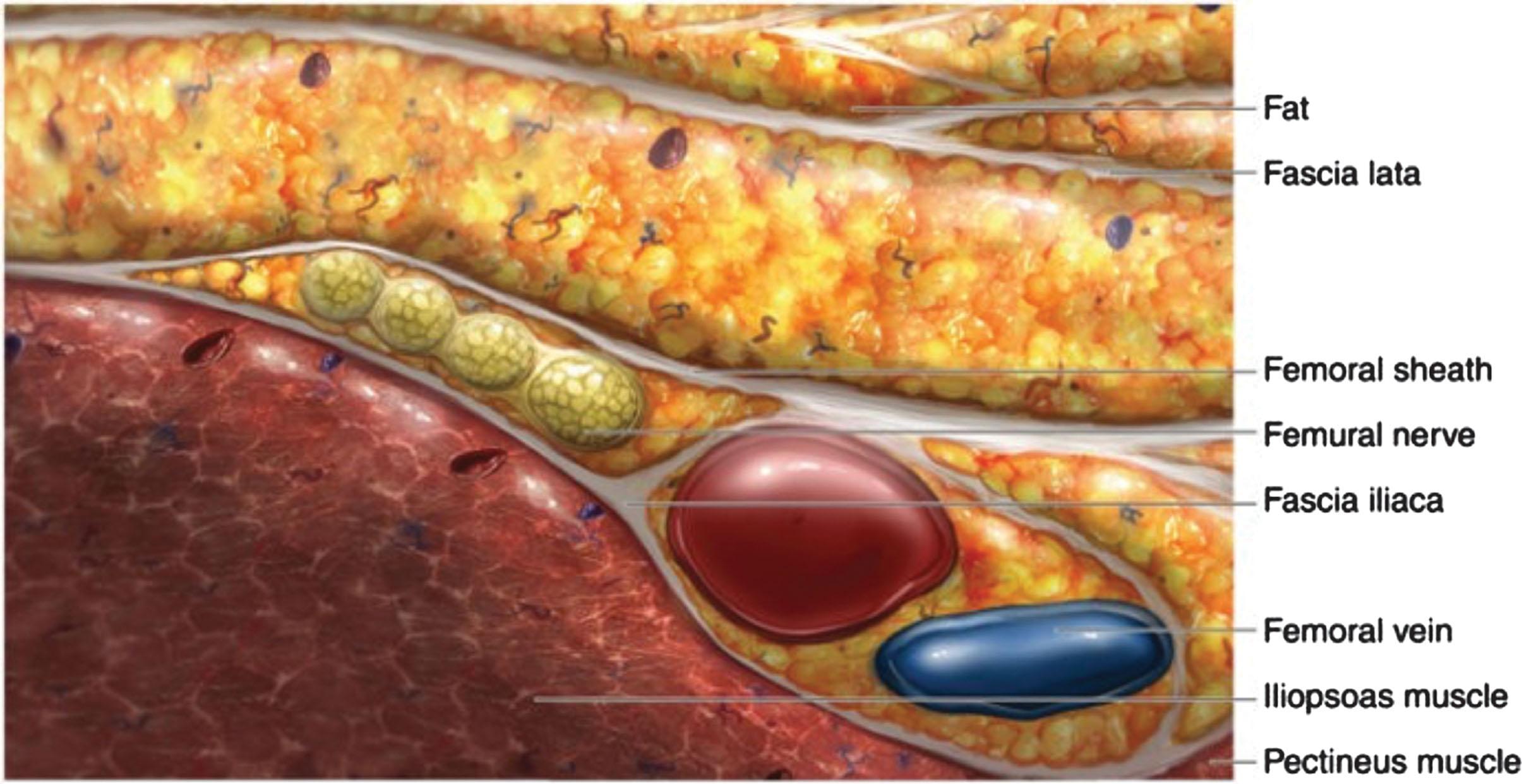 Figure 24.4, Tissue sheaths and femoral nerve in relation to femoral vessels.