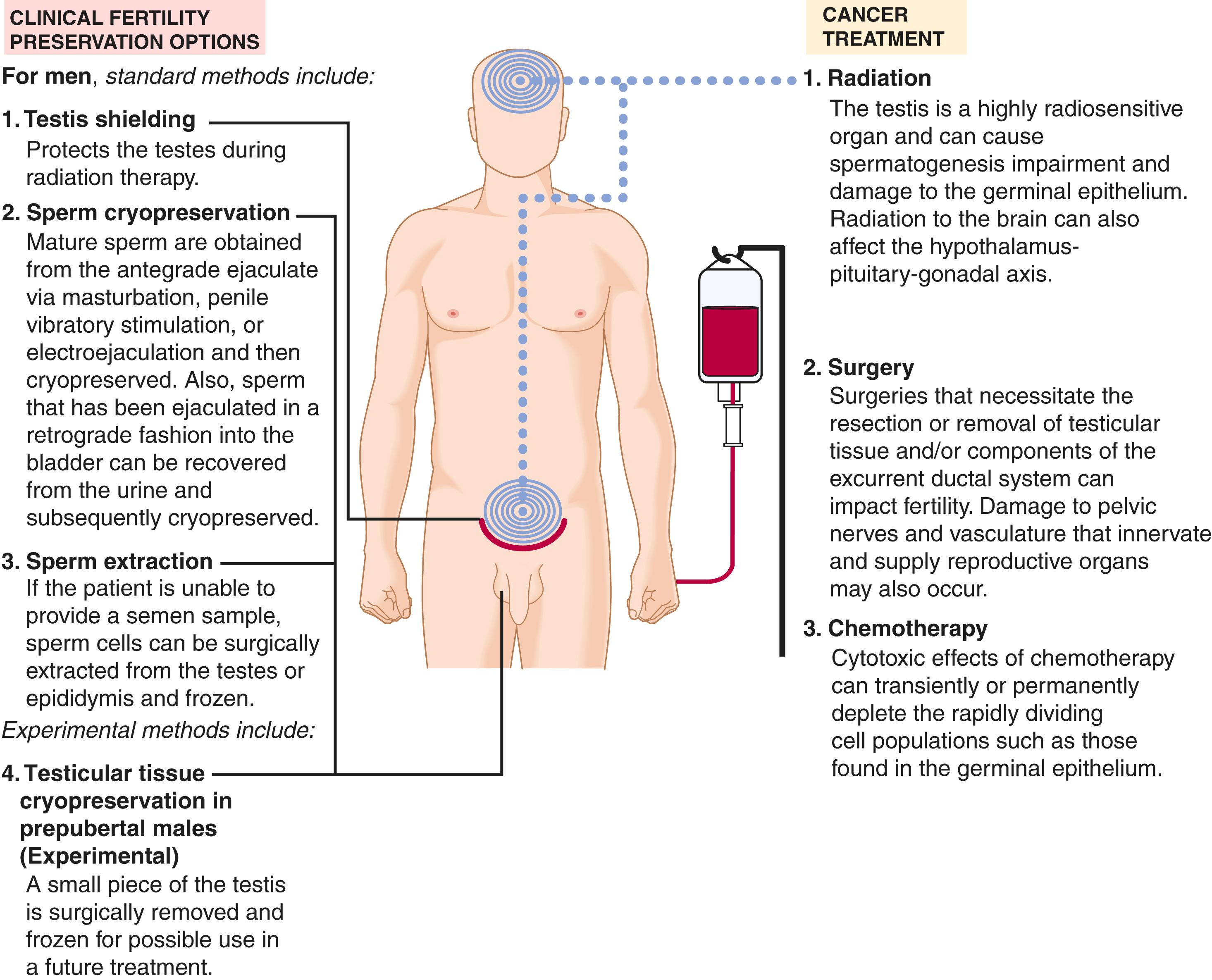 Fig. 37.2, Clinical fertility preservation options for men.