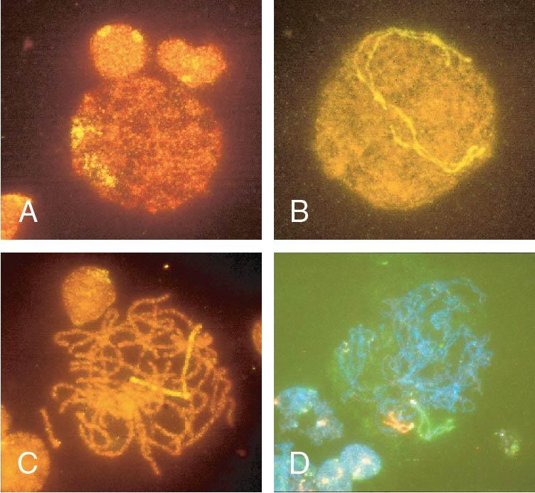 Fig. 1.3, Fetal ovary with fluorescent in situ hybridization. The first three images are meiotic cells from a 21-week fetal ovary. A, Fluorescent in situ hybridization (FISH) with a whole chromosome probe for chromosome X was completed to visualize the pairing characteristics of the X chromosome during leptotene. B, Zygotene. C, Pachytene. D, Image of a meiotic cell from a 34-week fetal ovary that underwent dual FISH with probes for chromosomes 13 ( green signal ) and 21 ( red signal ) to illustrate the pairing characteristics of this substage of prophase in meiosis I.