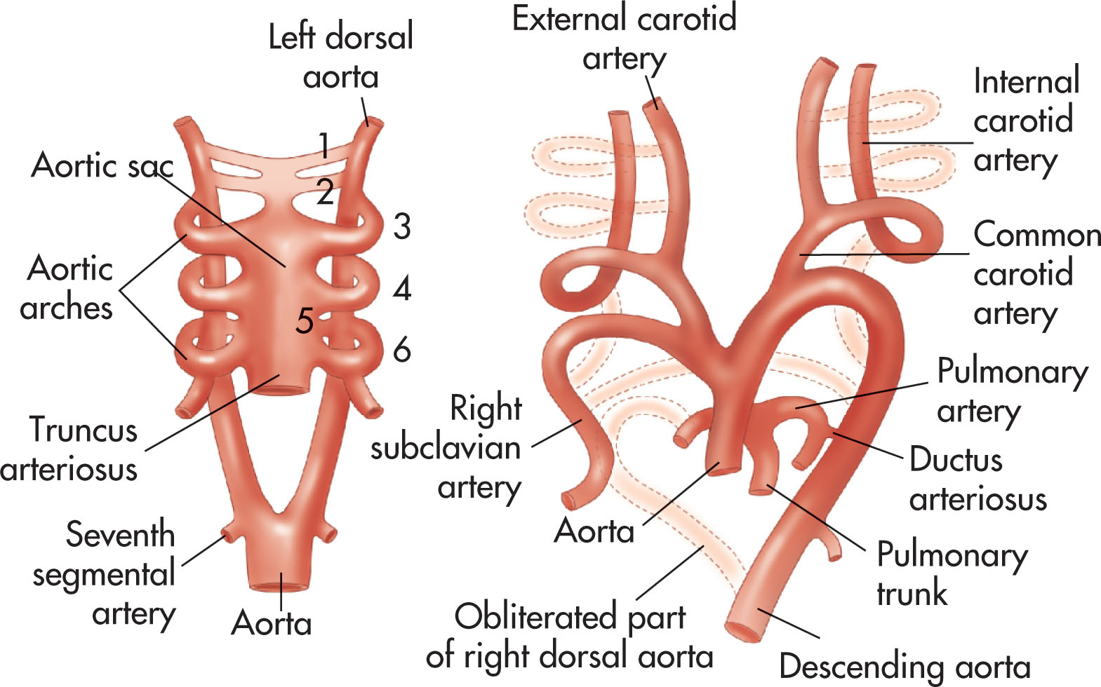 Fig. 35.2, Aortic arches in a 6-week embryo ( left ) and in an 8-week embryo ( right ).