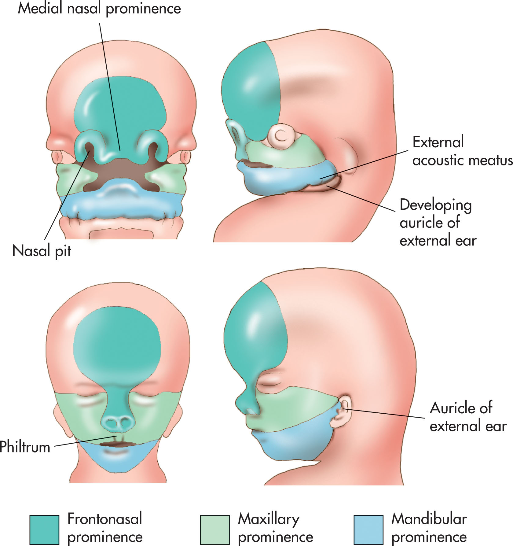 Fig. 59.3, Frontal view of the embryo at 40 days shows the nasal pit and the medial nasal prominence.