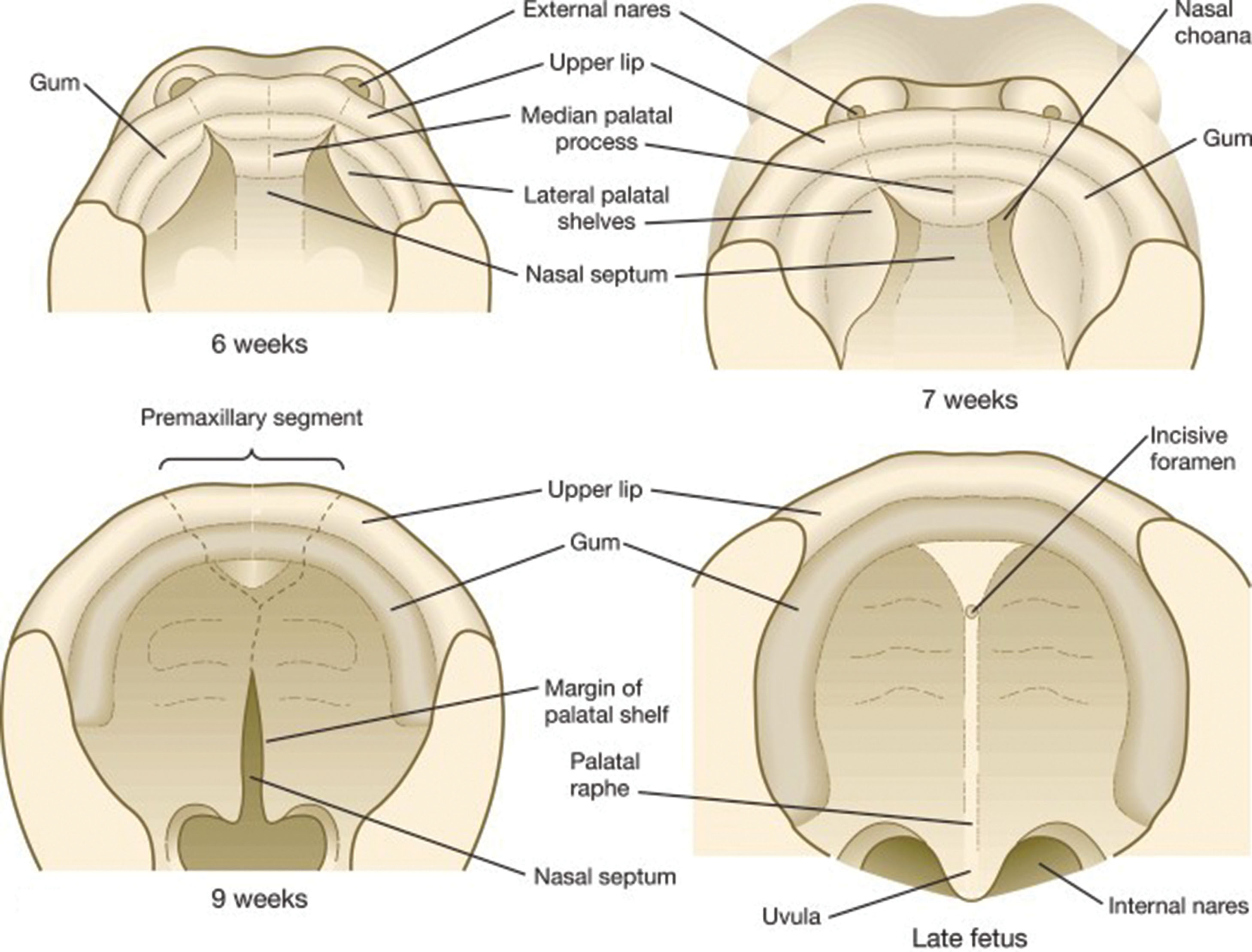 Fig. 59.5, Development of the primary palate.