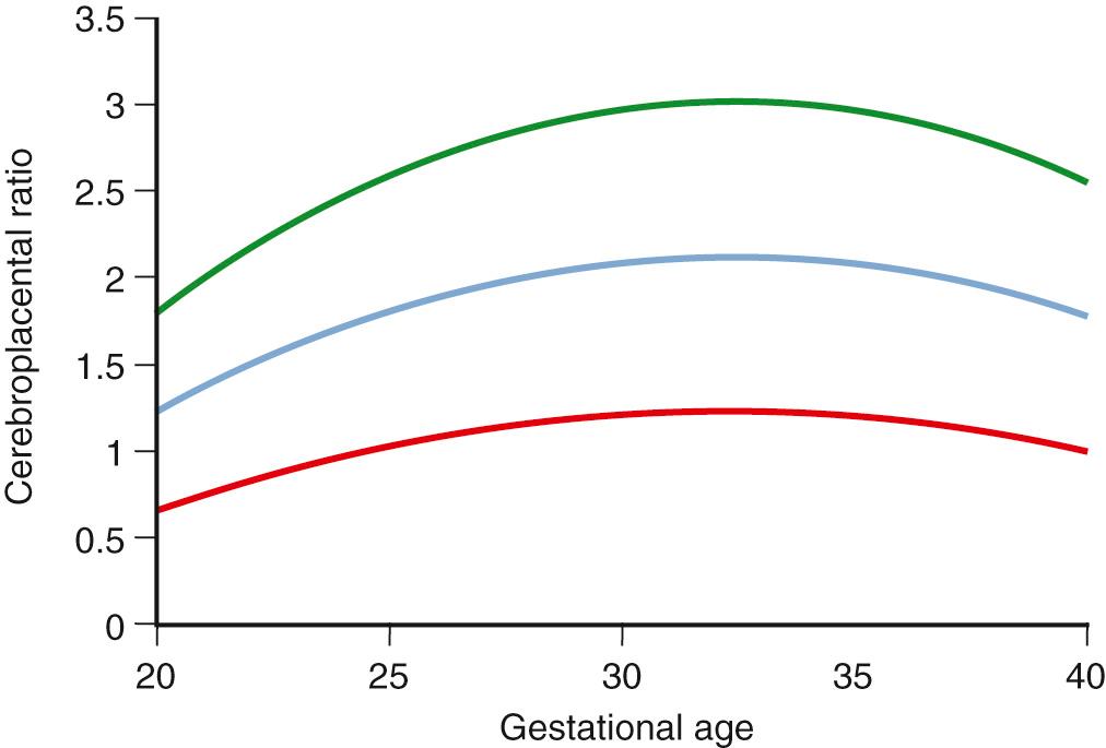 Fig. 30.11, Cerebroplacental Doppler Ratio With Advancing Gestational Age.