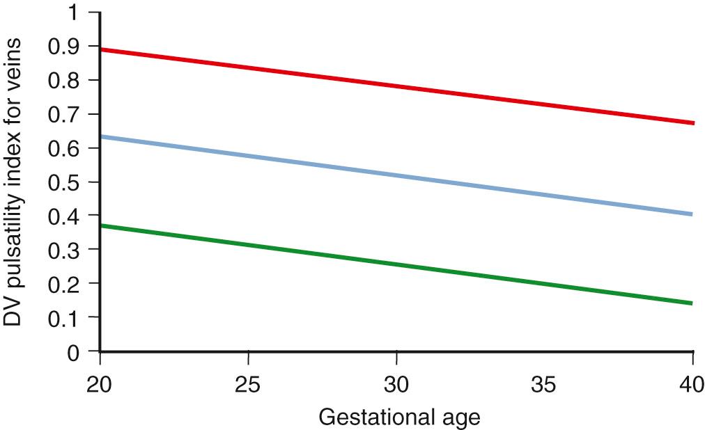 Fig. 30.12, Ductus Venosus (DV) Pulsatility Index for Veins With Advancing Gestational Age.