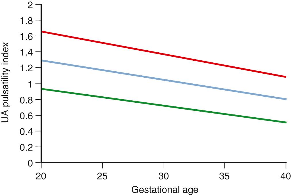 Fig. 30.9, Umbilical Artery (UA) Pulsatility Index With Advancing Gestational Age.