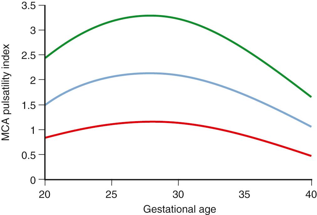 Fig. 30.10, Middle cerebral artery (MCA) pulsatility index with advancing gestational age. The graph shows the mean and 95% confidence intervals.