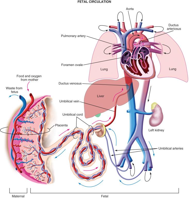 FIGURE 38.2, Fetal circulation. Red arrows represent flow of oxygenated blood and blue arrows represent flow of deoxygenated blood. Black arrows indicate direction of blood flow and represent travel of blood from the central circulation through capillary membranes and return to central circulation. Shading (from red to purple to blue) represents the corresponding relative oxygenation of the blood at that site, from oxygenated to deoxygenated. Note the mixing of blood as the ductus venosus delivers oxygenated blood from the placenta to the central fetal circulation and the progressive desaturation of blood in the fetal aorta secondary to shunts, consumption, and the return of deoxygenated blood from the fetal pulmonary circulation.