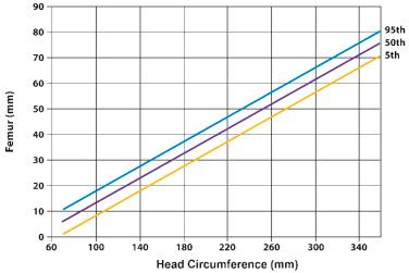 FIG 11-14, Relationship between the head circumference (mm) and the length of the femur (mm).