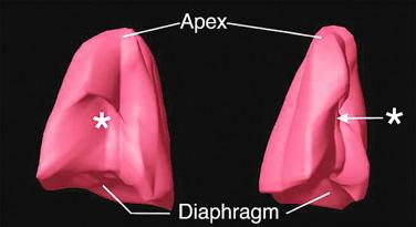 FIG 11-25, Three-dimensional ultrasound model of the right lung volume obtained using VOCAL. Note the indentation of the fetal heart ( asterisk ). The frontal view is shown on the left and the lateral view on the right.