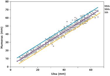 FIG 11-7, Relationship between the lengths of the ulna (mm) and the humerus (mm).