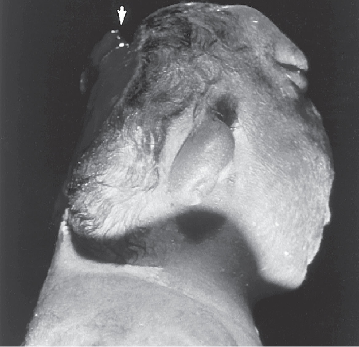 Fig. 60.2, Postmortem image of anencephaly.