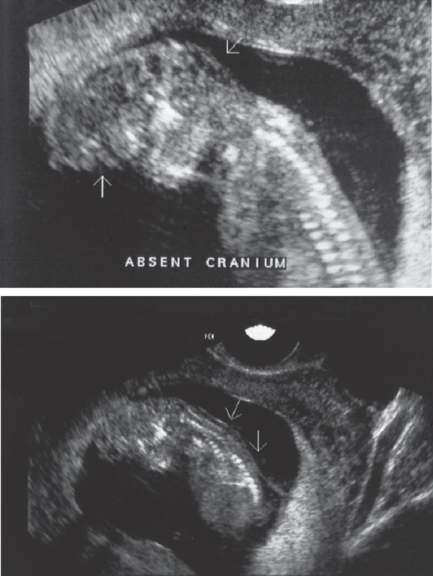 Fig. 60.4, Acrania.