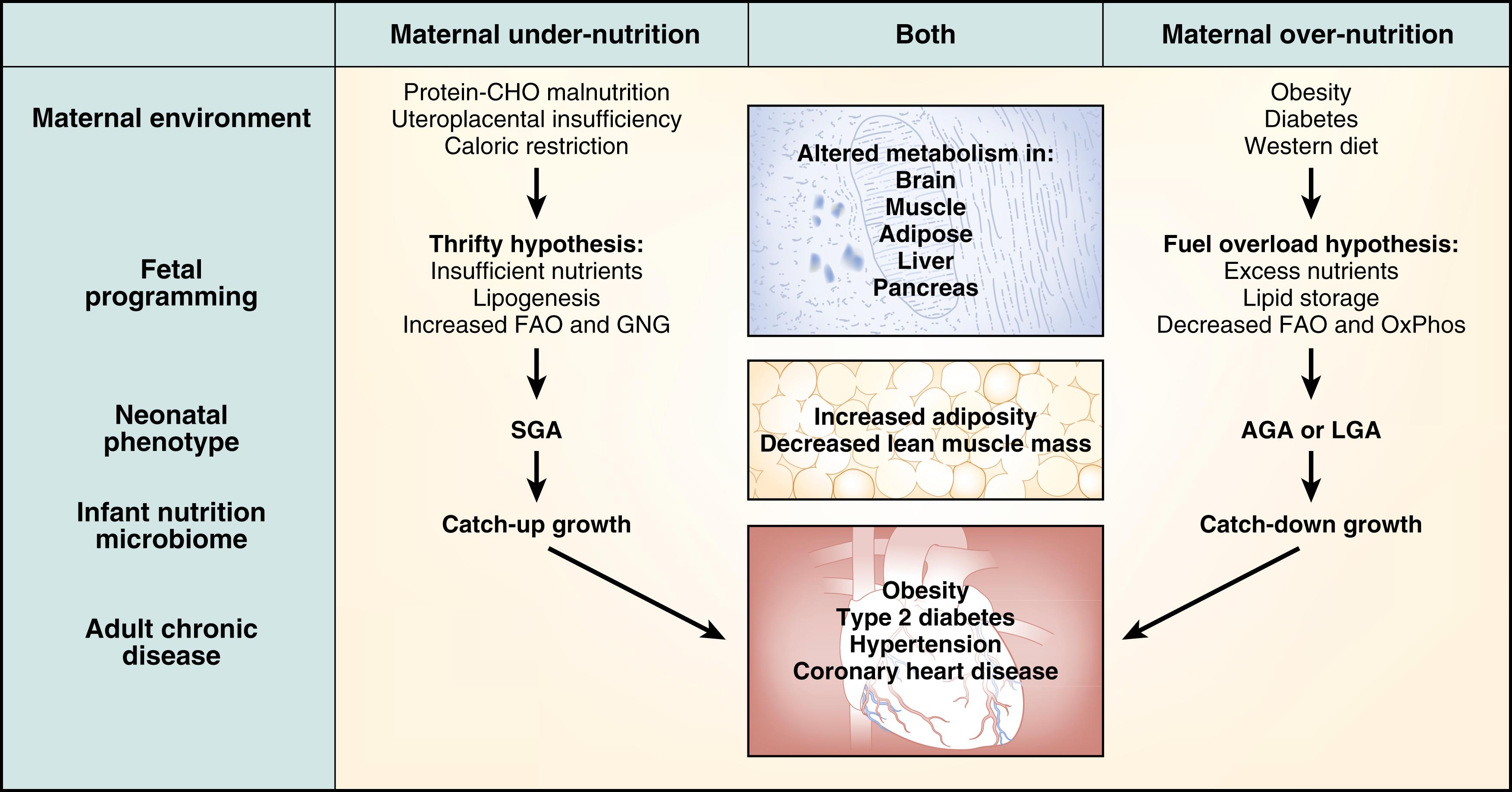 Fig. 13.1, Comparison of maternal undernutrition and overnutrition as causes of chronic adult metabolic disease in offspring. AGA, Appropriate for gestational age; CHO, carbohydrate; FAO, fatty acid oxidation; GNG, gluconeogenesis; LGA, large for gestational age; OxPhos, oxidative phosphorylation; SGA, small for gestational age.