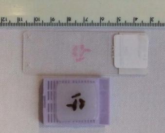 FIGURE 22-1, A paraffin block with accompanying slide demonstrating the small amount of tissue usually required from each organ for histological examination.